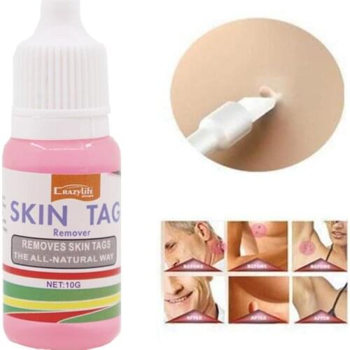 10ML Remover Skin Tags All-natural Way Removal of Warts Liquid Skin Tags Removing Against Moles Wart Remover Foot Corn Removal