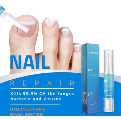 Powerful Nail Treatment Pen Onychomycosis Paronychia Anti Fungal Nail Infection Chinese Herbal Toe Fungus Care Repair Serum