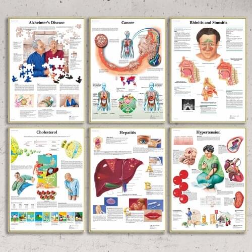 Principles Of Disease Disease Prevention Common Diseases Propaganda Poster Canvas Painting Wall Art Pictures For Hospital Decor