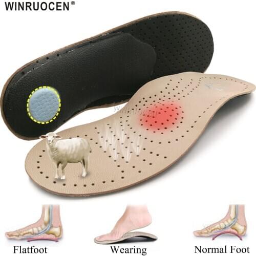 WINRUOCEN Genuine Leather XO Leg Flat Feet orthotic insoles High Arch Support Flat Feet Women Men orthopedic Foot pain Unisex