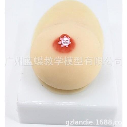 Lactation Unilateral Silicone Breast Model Prolactin Division Ducational Training Equipment Prolactin Training Medical Teaching