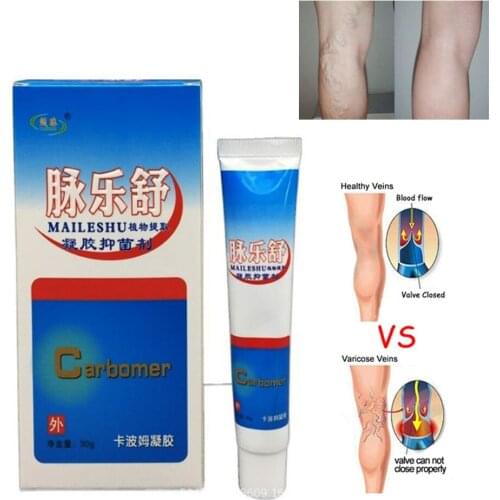 Varicose Veins Cream Varicose Veins Medical Plaster Spider Veins Treatment Chinese Medicine Varicose Veins Ointment Health Care