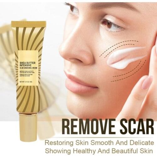 40g Face Body Scar Acne Repair Gel Anti-blemishes scars tracks Repair Lotion Moisturizing Smoothing Gel