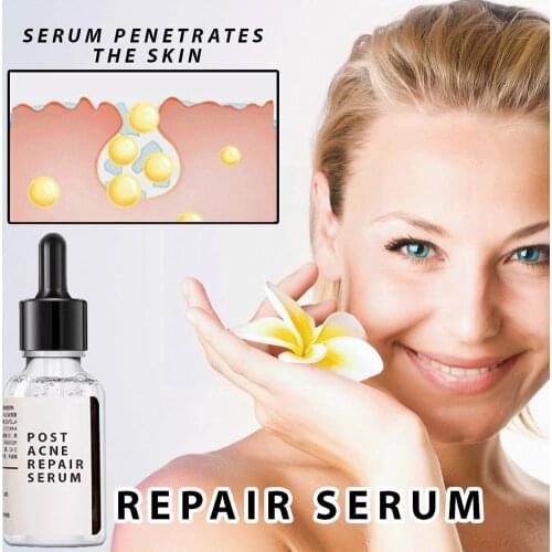 30ml Salicylic Acid 2% Solution Removes Acne Face Serum Pore Skin Essence Moisturizing Care Face Spot Brighten Shrinks Fade Y7V2