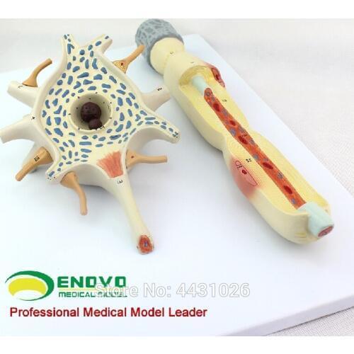 ENOVO The medical human anatomy system was enlarged by the amplification model