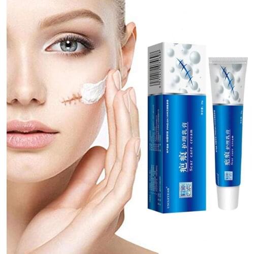 Acne Scar Removal Cream Ointment Pimples Stretch Marks Face Gel Remove Acne Smoothing Whitening Moisturizing Body Skin Care