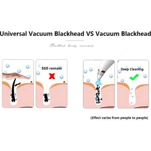 Strong Suction Comedone Extractor Tool Face Vacuum Acne Removal Blackhead Sucker Pore Vacuum Cleaner Blackhead Remover