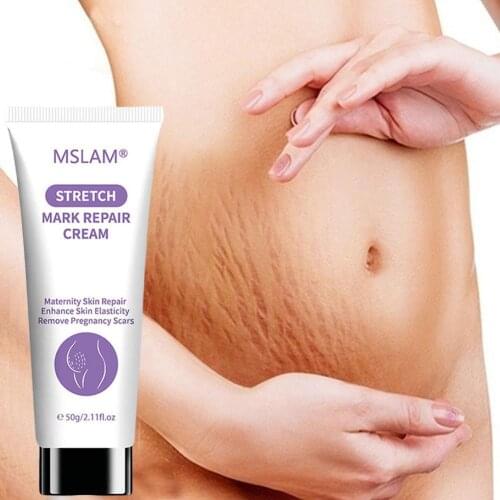 Stretch Mark Repair Cream Pregnancy Scars Ance Maternity Growth Firming Anti Body 50ml Reduce Aging Line Fat Cream Lines Ca S1H5