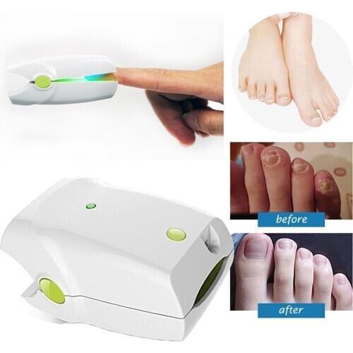 Rechargeable Nail Fungus Clean Laser Treatment Device Cure Onychomycosis Professional Toe Finger Nail Fungus Treatment Machine