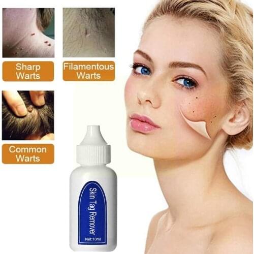 Non-marking Beauty Pen To Remove Warts Beauty Liquid Calluses Corns And To Warts Pencil Eye Remove T8Q0