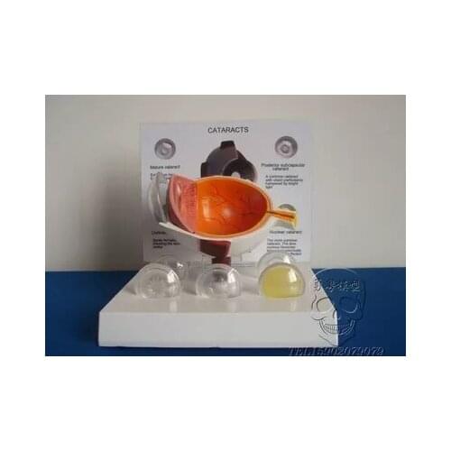 Human lesion eyes model Eyes magnified