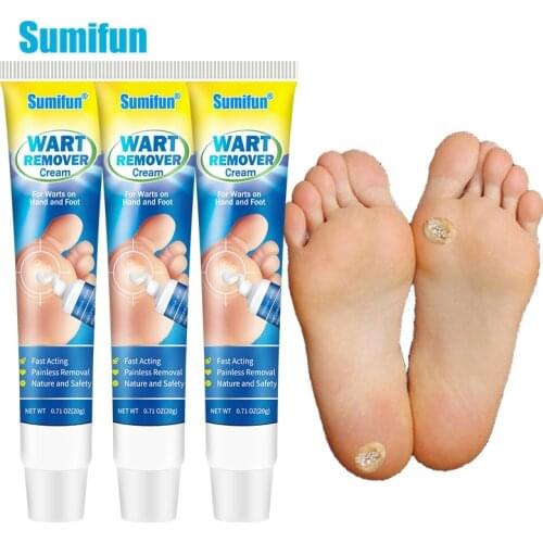 1/3pcs Sumifun Skin Tag Warts Remover Ointment For Face Body Genital Anti Foot Corn Moles Dark Spot Plaster Against Mole Cream