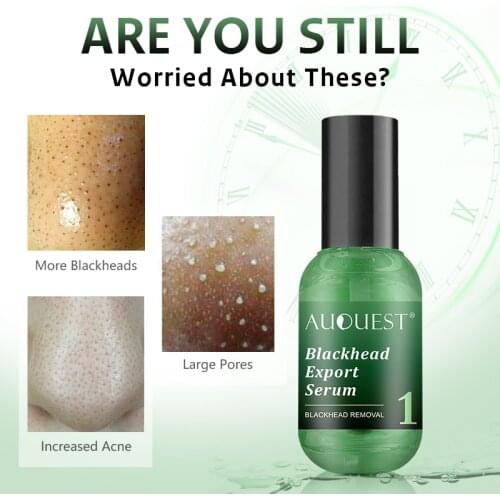 1pcs 15ml Blackhead Derivative Liquid Refining Pore Essence Soften Cuticles, Reduce Acne Marks and Acne