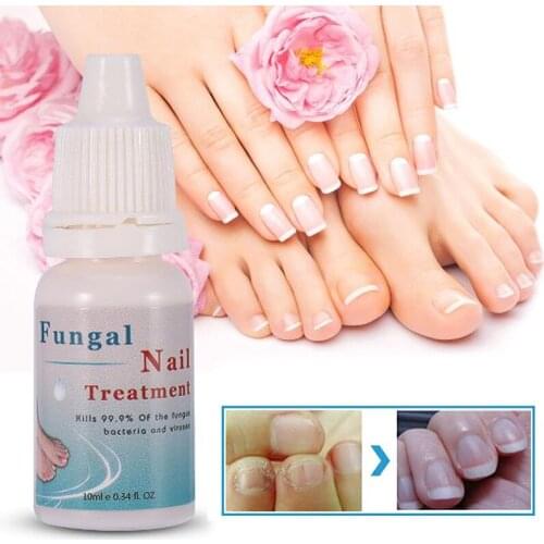 Firstsun 10ml Nail Fungus Nail Repair Liquid Sterilization Nail Treatments Onychomycosis Moisturizing Nourishing Nail Care TSLM1