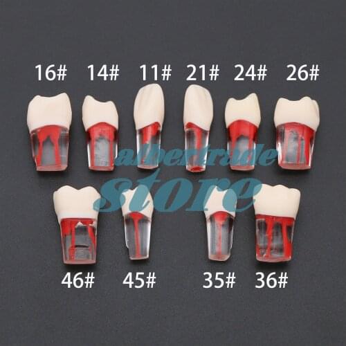 10Pcs Dental Endodontic File Teeth Model Root Canal RCT Practice Pulp Study