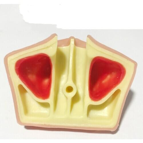 Oral Cavity Dental Implant Lifelike Teeth Model Teaching Aids Bone Imitating Realistic Antrum Highborn Dental Implants Models