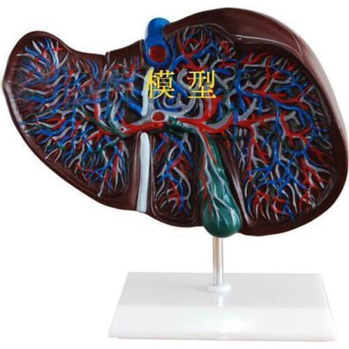 Liver anatomy model, liver and gallbladder enlargement model Medical teaching supplies