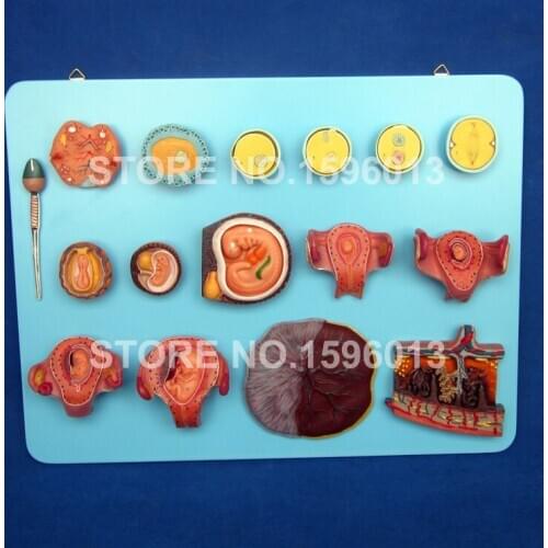 Human Fertilization and Early Embryogeny Model, Anatomical Embryos,Ovary,Fetus Models