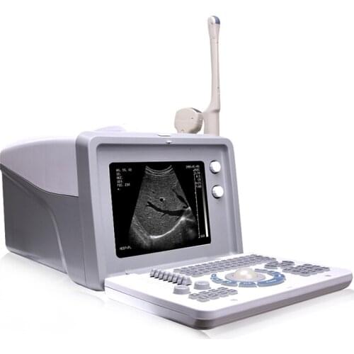 12 Inch HD LCD display rechargeable battery cheap price portable ultrasound machine