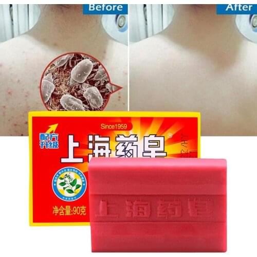 90g Red China Medicated Soap Conditions Acne Psoriasis Seborrhea Eczema Anti Fungus Bath Healthy Soap Slimming Body Cream