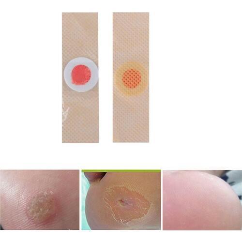 10 Pcs Foot Care Tool Medical Sticker Toe Protector Foot Corn Remover Calluses Plantar Warts Thorn Pain Relief Plaster Plaster