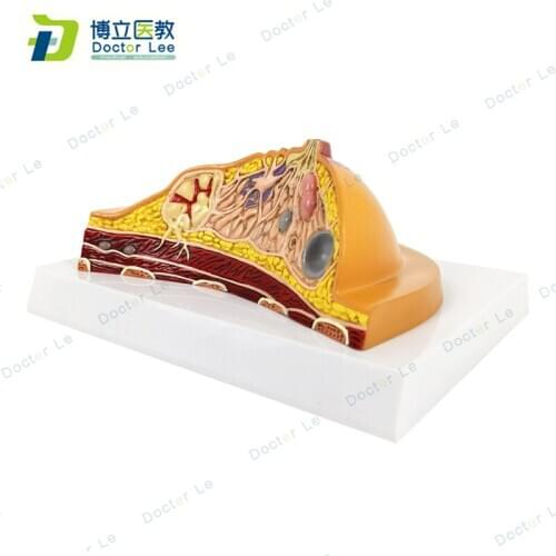 1:1 Median Section of Artifical Pathological Female Breast Anatomical Model Kit Table-type Breast Lesion Model Lactating breasts