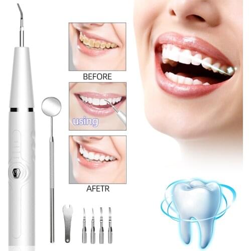 Kyliebeauty Oral Irrigator