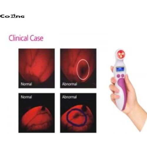 Portable Mini-Expert Breast Cancer Detection Monitor Infrared Self Check Device Health And Beauty Product
