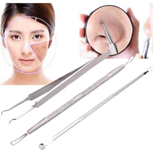 50% Hot Sale 3 Pcs Blackhead Acne Pimple Blemish Extractor Remover Clip Needle Tweezers Tools
