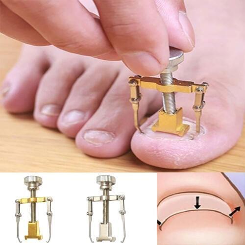 Ingrown Toenail Toe Fixer Recover Correction Device Pedicure Foot Nail Care Tool