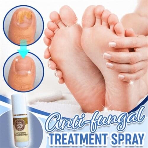 Anti-Fungal Treatment Spray Fungal Combat Feet Spray Foot Sterilize Spray Anti-Fungal Toe Treatment Onychomycosis Anti Bacterial
