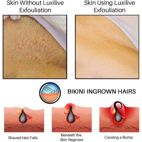 100ml Bumps Solution Aftershave Serum for Razor Bumps After Hair Removal