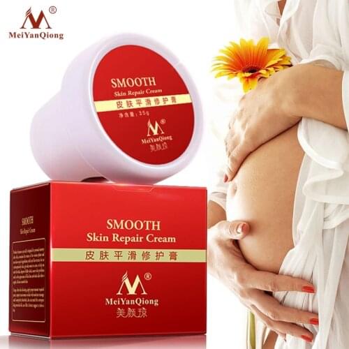 Smooth Skin Cream For Stretch Marks Scar Removal To Maternity Skin Repair Body Cream Remove Scar Care Postpartum