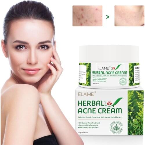 Herbal Acne Treatment Face Cream Anti-wrinkle Repair Acne Remove Wrinkles Moisturizer Shrink Pores Whitening Facial Skin Care