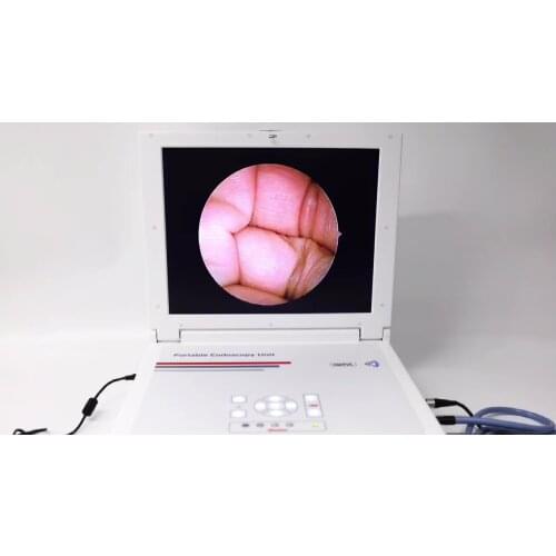 Portable Endoscope CCD Camera with Medical Monitor, Led Light Source and HD Recorder