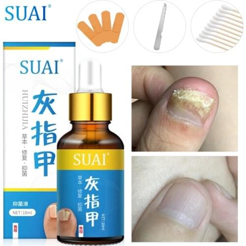Nail Treatment Serum Onychomycosis Paronychia Anti-Fungal Nail Infection Herbal Toe Fungus Foot Repair Essence Care 10ml
