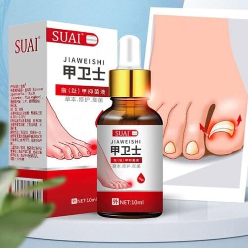 Nail Fungal Treatment Feet Care Essence Nail Foot Whitening Toe Nail Fungus Removal Gel Anti Infection Paronychia Onychomycosis