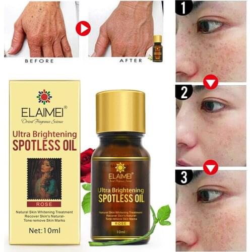 Natural Rose Plant Spot Removal Essential Oil Whitening Face Serum Body Massage Care Moisturizing Brightenig Freckle Skin Care