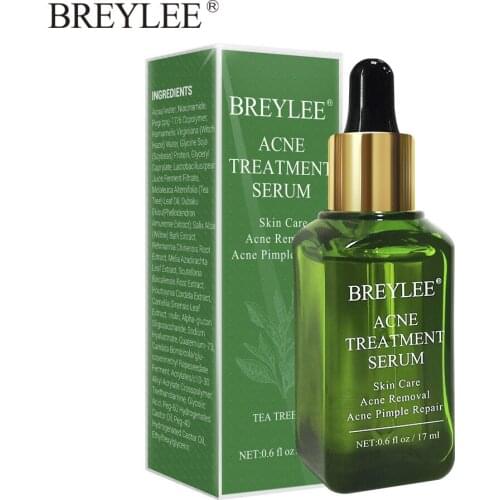 BREYLEE Acne Treatment Face Serum Mask Anti Acne Pimple Scar Remover Moisturizing Whitening Skin Care Facial Essence Cream 17ml
