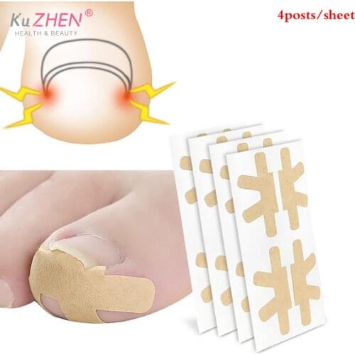 Pedicure Ingrown Nail Tool Toenail Stickers For Nail Corrector Paronychia Treatment Fixer Recover Bunion Pedicura Feet Care Tool
