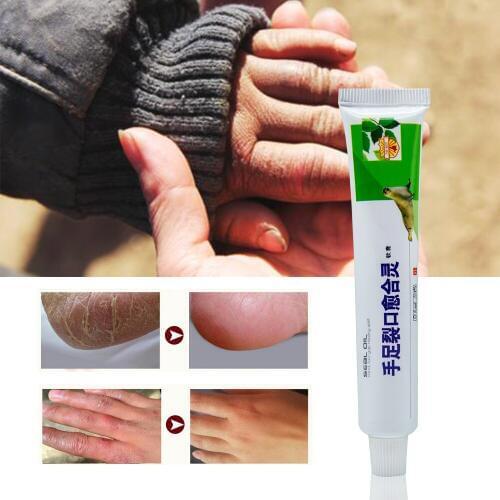 Sumifun Hand Foot Crack Ointment Heel Chapped Peeling Foot Hand Repair Anti Dry Crack Cream Chinese Medical Plaster P1040
