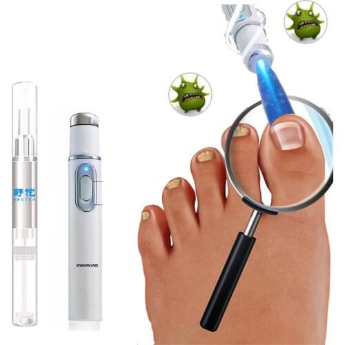 Anti-fungal Home Treatment Set Toe Nail Treatment Pen Onychomycosis Paronychia Anti Fungal Fungus Care Repair Serum Kit