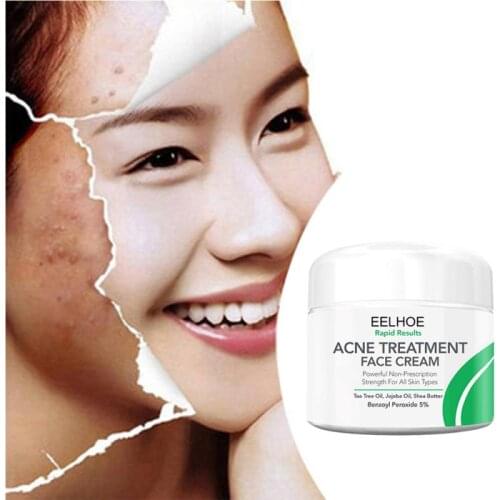 Eelhoe 10/30/50g Face Cream Anti Stains Acne Treatment Scar Blackhead Shrink Pores Whitening Moisturizing Face Skin Care TSLM2