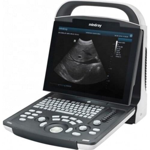 Mindray DP-20 Portable Ultrasound Price Ultrasound Machine For Sale