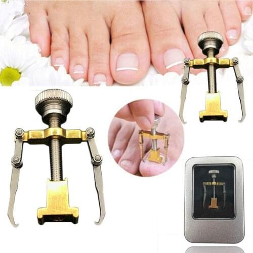 Ingrown Toenails Pedicure Foot Nail Care Tools File for Feet Orthotic Acronyx Ingrowing Nail Onyxis Bunion Corrector Massage