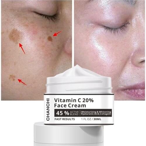 Face Cream Vitamin C 20% Whitening Remove Dark Spots Facial Cream Repair Fade Freckls Melanin Remover Brighten Skin 30m