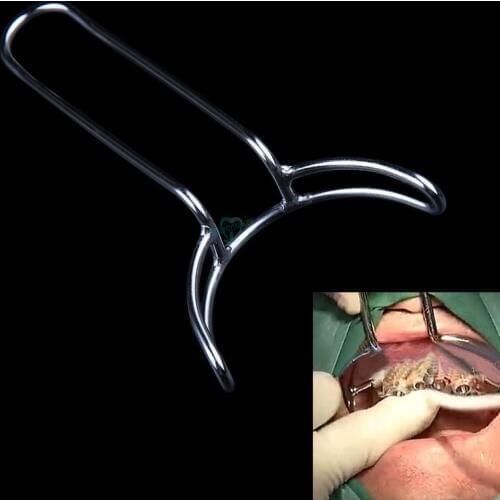 8cm Dental Implant Grote Mond Gag Opener Tanden Retractor Tandarts Chirurgisch Instrument Tool Tand Whitening Tool Oral Care