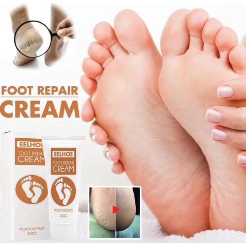 Foot Care Cream Foot Scrub Exfoliates Dead Skin Callus Remover Foot Repair Care Moisturizing Cream
