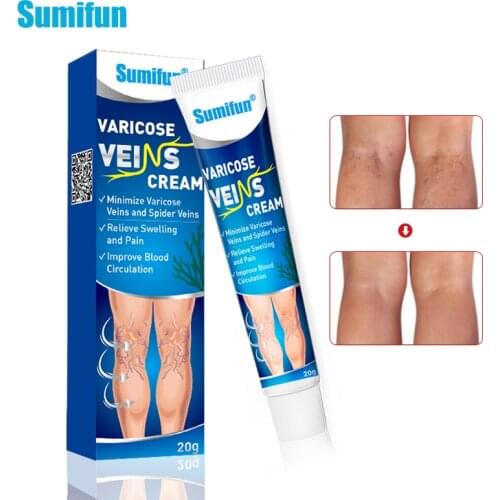 1Box Sumifun Varicose Veins Treatment Cream Phlebitis Varicosity Angiitis Spider Leg Ointment For Relief Leg Pain Numbness P1234