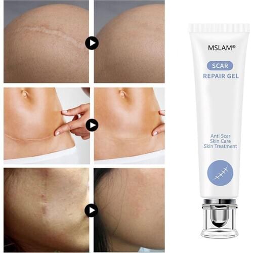 Scar Repair Gel Removal Scar Acne Cream treatment Marks For Face Body Pigmentation Corrector Skin
